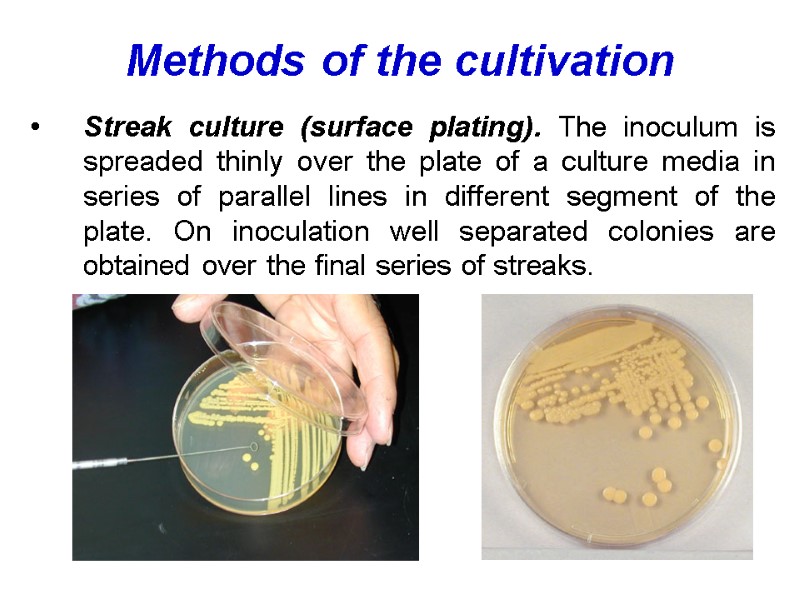 Methods of the cultivation  Streak culture (surface plating). The inoculum is spreaded thinly